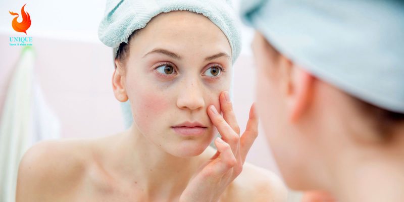 7 Nguyên Nhân Khiến Da Lão Hóa Bạn Cần Biết & Phương Pháp Điều Trị Tốt Nhất